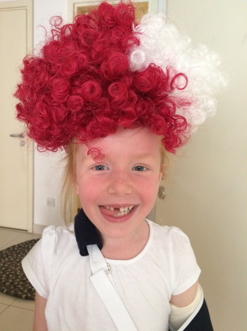 Cilles brækkede albue 13